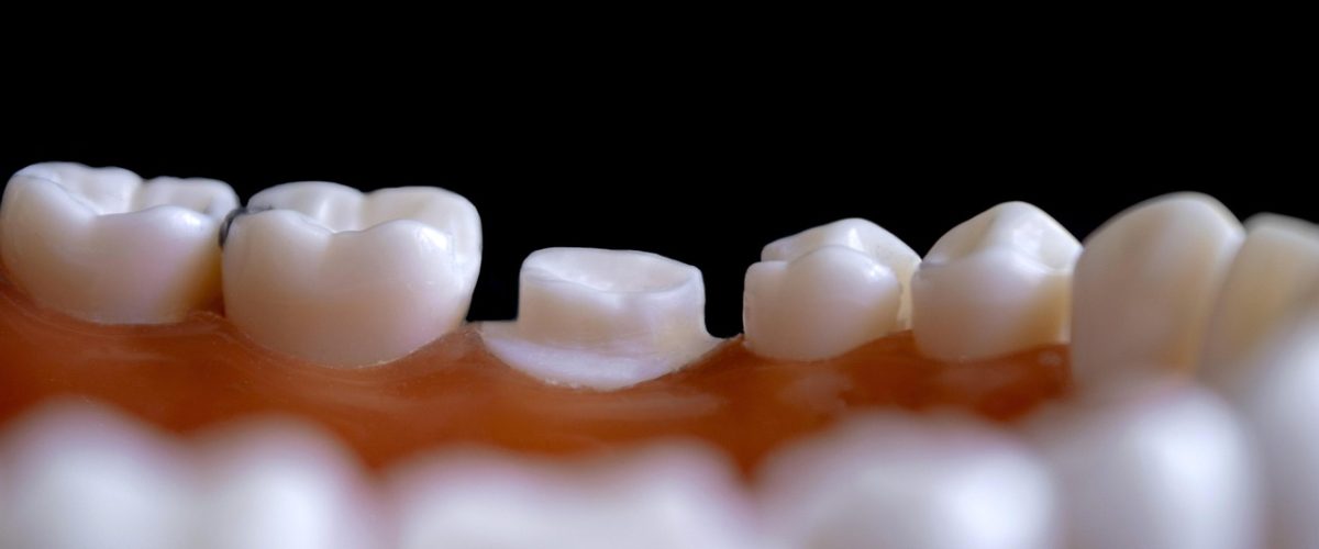 odontology, tooth, hygiene, treatment, dentist, orthodontics, odontology, odontology, tooth, tooth, tooth, tooth, tooth, dentist, dentist, dentist, dentist, dentist, orthodontics